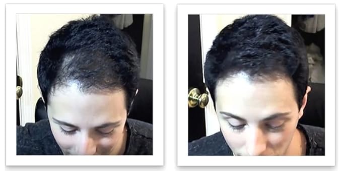 Hair Powder For Thinning Hair. Makes Thin Hair Look 10X Fuller, Covers Bald Spot Instantly. All-Natural Hair Building Fiber. Trial Size (10-Day Supply). Black