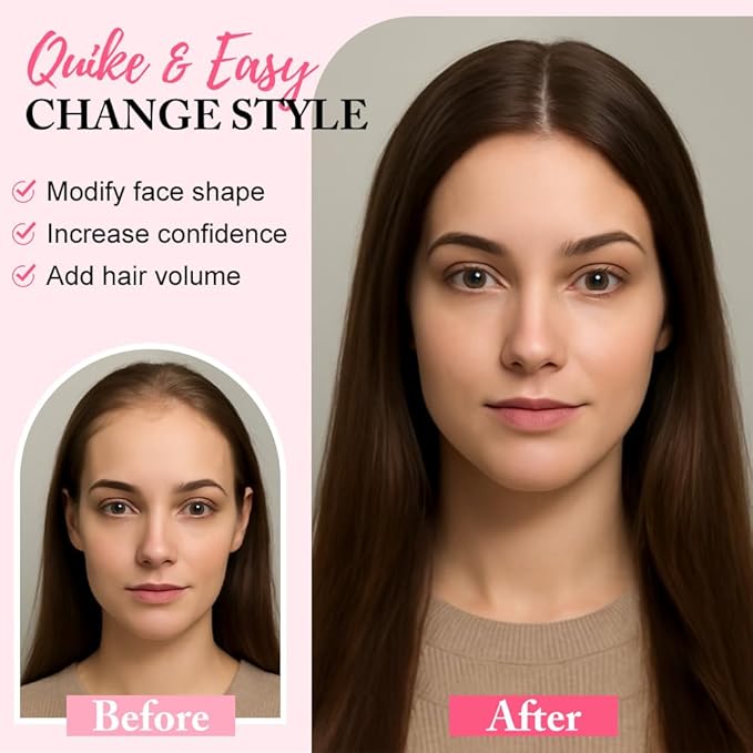 Hair Toppers for Women Real Human Hair Topper for Women with No Bangs Hairpieces Comfortable and Breathable 10 Inch Swiss Base 3D 360°Cover (Medium Brown to Creamy lced Blond, 10 Inch-3D-Side)