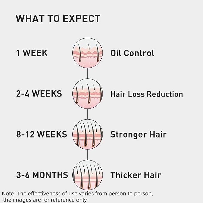 KINTOR 0.5% 0.9% KX-826 Hair Regrowth Spray,Reduce Fuller-looking Healthier Hair,Oil Control, Hair Care Products Group for Men&Women,3 Bottles, Basic,Plant-Based,Pro