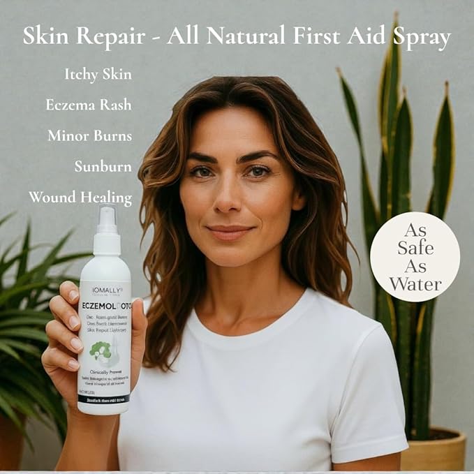 Loma Lux New Eczemol OTC Spray Natural & No Sting Hypochlorous for Eczema, Wounds, Burns, Cuts, Radiation Dermatitis, Skin Irritation, Sunburn, Itchy Skin, for Kids & Adults (8 Fl Oz.)