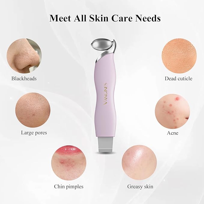 Blackhead Scraper Tool & Skin Scrubber Face Spatula for Blackhead Removal, Pore Cleaning, with Cooling Ice Roller & 2 Silicone Brush Heads (Berry Mauve)