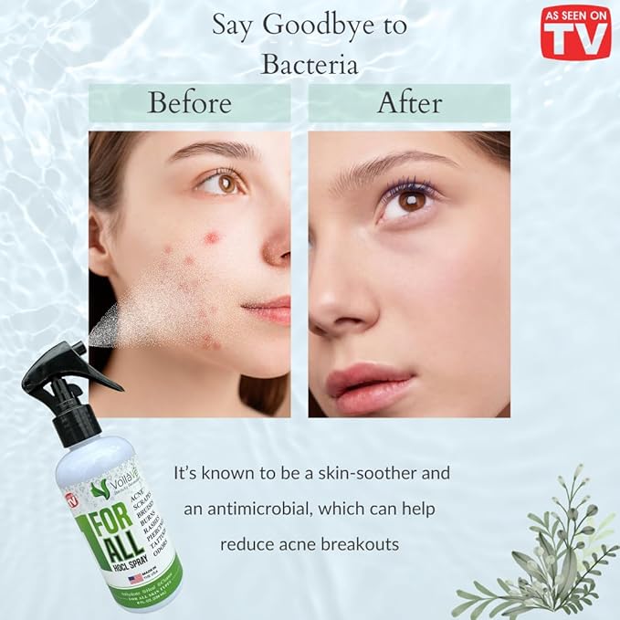 VoilaVe Pure Hypochlorous Acid Spray, All-in-One Skin Spray for Every Skin Type | HOCL Spray | Supports Acne, Scraps, Bruises, Rashes, Piercings, Tattoos, and Odors | Multi-Purpose Cleaner Spray 8 Oz