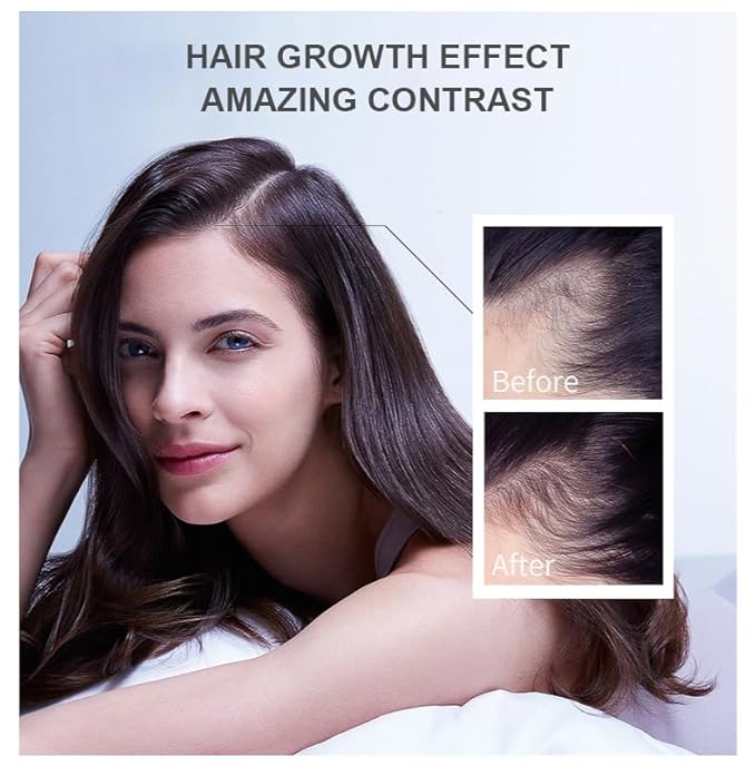 Vedora Ginger Oil for Hair Growth - Biotin Hair Growth Serum, 100% Pure Natural Ginger Essential Oil - Promotes Stronger, Thicker, Longer Hair in Women & Men - 1.05 Fl Oz / 30ML (1PC)