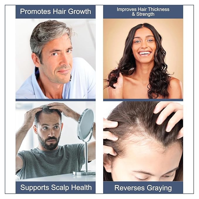 Hair Wellness Supplement | 360 Tablets – 6-Month Supply | Daily Nutritional Support for Hair Strength, Thickness & Scalp Care | 17-in-1 Formula for Men & Women (Pack of 1)