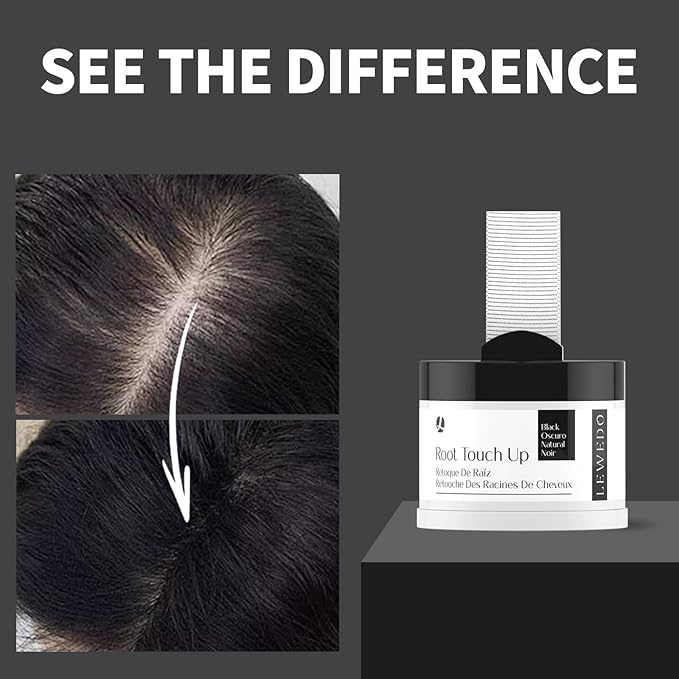 Hairline Powder 24H Stain-Proof, Root Touch Up Hair Color for Gray Coverage,Bald Spot Concealing Hair Shadow Powder for Women & Men,Natural-Looking (Medium Blonde)