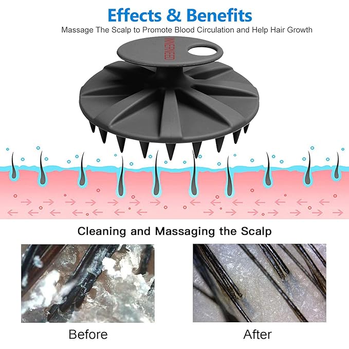 INNERNEED Scalp Massager Shampoo Brush, Wet & Dry Manual Scalp Care Head Scrubber Hair Washing, Soft Silicone Bristles, for Hair Growth, Dandruff Removal (Pack of 4)