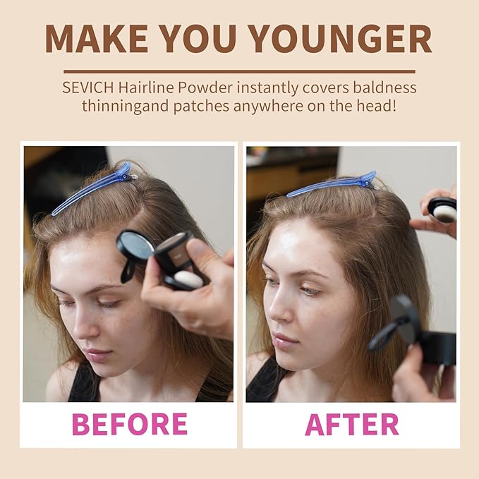 SEVICH Hairline Powder - Instantly Cover Grey Hair and Thinning Hairline, Eyebrows & Beard Line Touch Up, Windproof & Sweatproof, Auburn