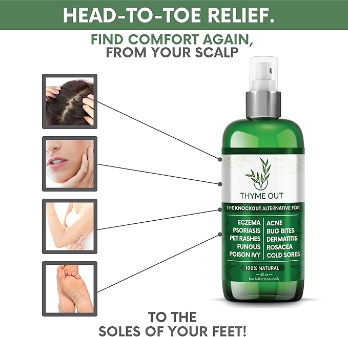 All Natural Eczema Treatment- Psoriasis Treatment - an All-in-One Solution for Acne, Dermatitis, Rosacea, Cold Sores, Bites, Poison Ivy - Anti-Itch Spray for Itchy Skin Relief 4oz