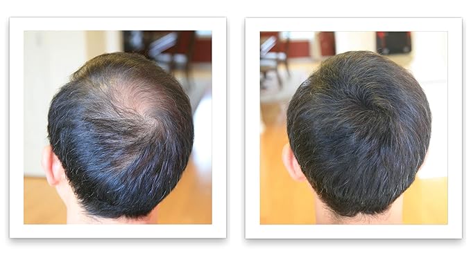 Caboki Hair Volumizer: Root Touch Up & Fill in Thinning Hairline, Cover Bald Spots & Gray Hair. TALC-Free, Healthful Powder for Men & Women. Golden Blonde