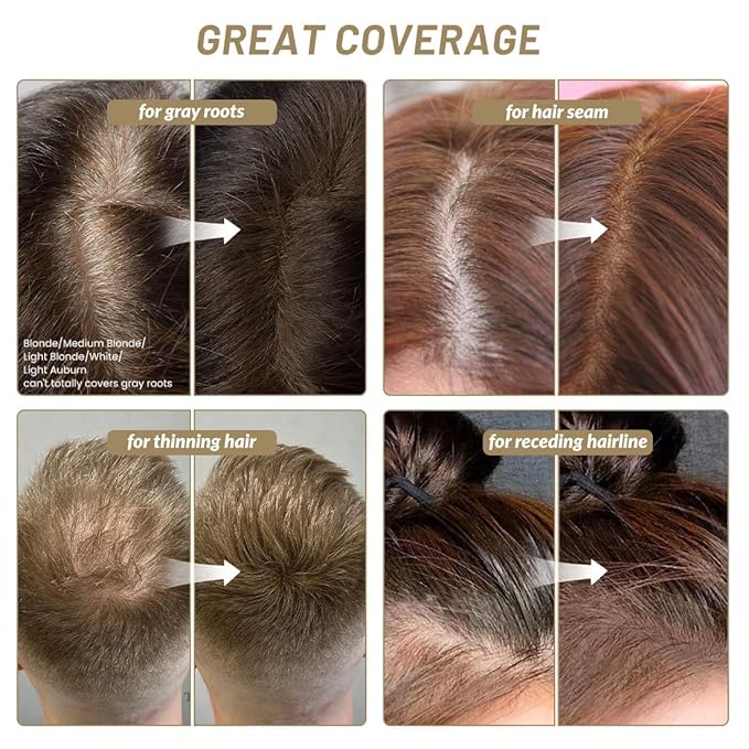 SOVONCARE Hairline Powder - Root Touch Up & Gray Hair Concealer for Men and Women, Instantly Covers Thinning Hair and Bald Spots, Natural-Looking Coverage Gray