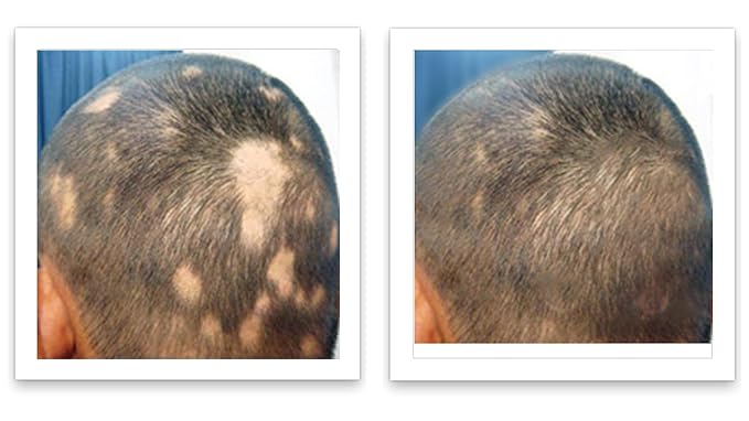 Caboki Root Touch Up Powder: Fill in Thinning Hair, Hairline & Edges, Cover Bald Spots & Gray Hair - TALC-Free, Volumizing Hair Fiber for Men & Women in Salt & Pepper and Dark Shades