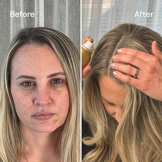 STYLE EDIT DARK BLONDE Root Concealer Touch Up Spray Instantly Covers Greys And Dark Roots - Professional Salon Quality Blonde Perfection Grays Cover Up Hair Products for Women 4 Ounce PACK OF 5