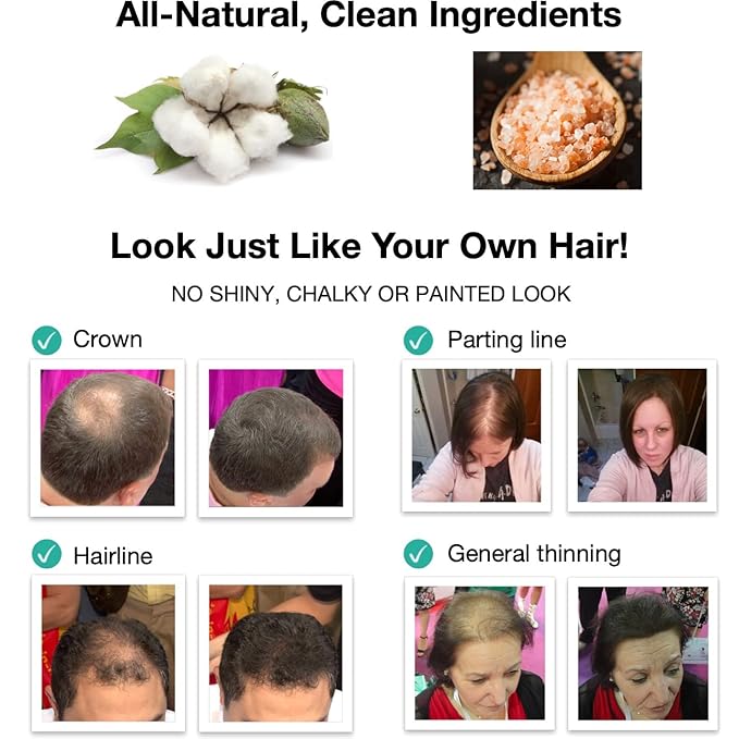 Hair Powder For Thinning Hair. Makes Thin Hair Look 10X Fuller, Covers Bald Spot Instantly. All-Natural Hair Building Fiber. Trial Size (10-Day Supply). Black