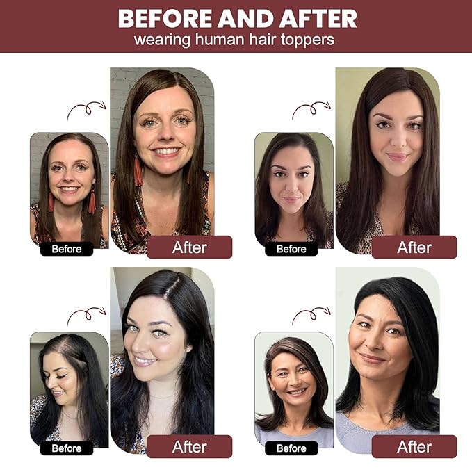 YAMI Hair Toppers for Women with Thinning hair 100% Real Human Hair Toppers 40g Human Hair Toppers for Women Clip In Hair Topper Swiss Base 12inch Medium Brown with Highlight