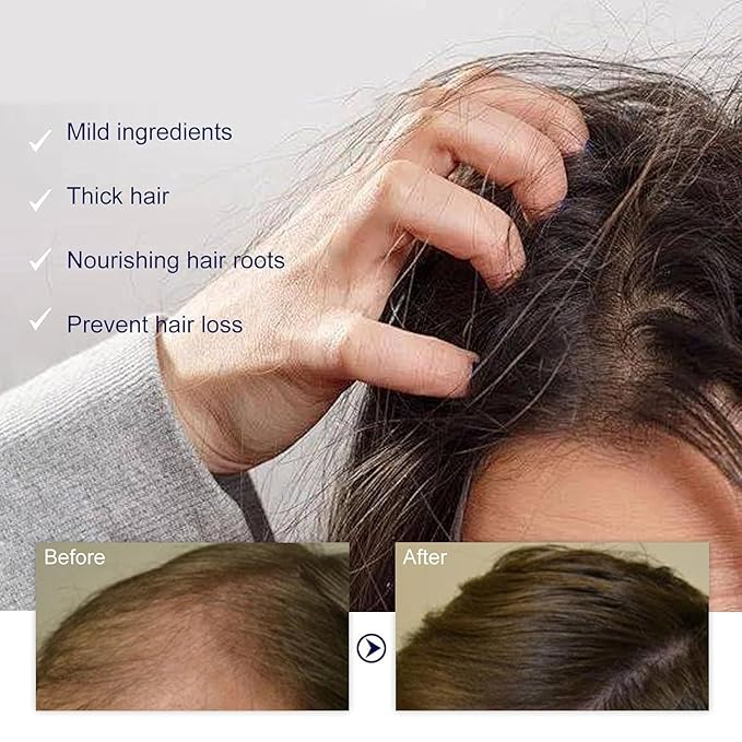 GHK-Cu Peptide, GHK-Cu Copper Peptide Hair & Scalp Serum – 2400mg, Dry Scalp Moisturizer Spray, 4% Copper Peptides – Fast-Absorbing, Water-Based Formula for Hair Softness & Shine