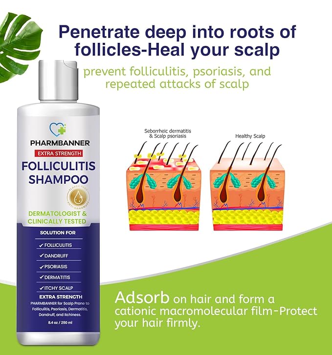 Anti-Fungal Shampoo for Folliculitis, Seborrheic Dermatitis, Scalp Psoriasis - Relieves Itchy & Dry Scalp
