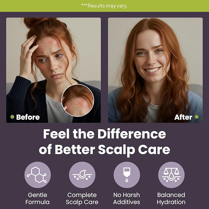 Marie Originals Eczema & Psoriasis Nourishing Shampoo and Conditioner Bundle – Itchy Scalp Relief, Dry Scalp Shampoo & Hydrating Conditioner with Tea Tree, Lavender & Peppermint – 8 oz Each