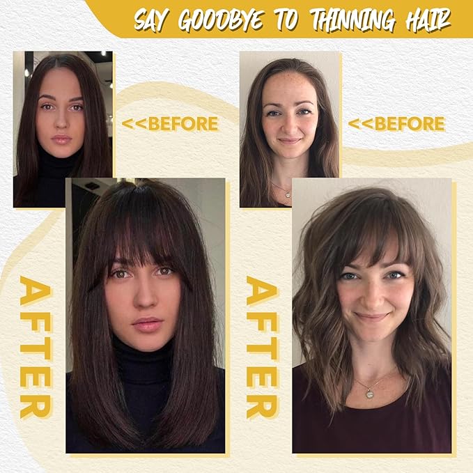 Hair Toppers for Women Real Human Hair Toppers for Women with Bangs 100% Real Human Bangs 10 inch Swiss Base Hairpieces for Thinning Hair（Natural Black）