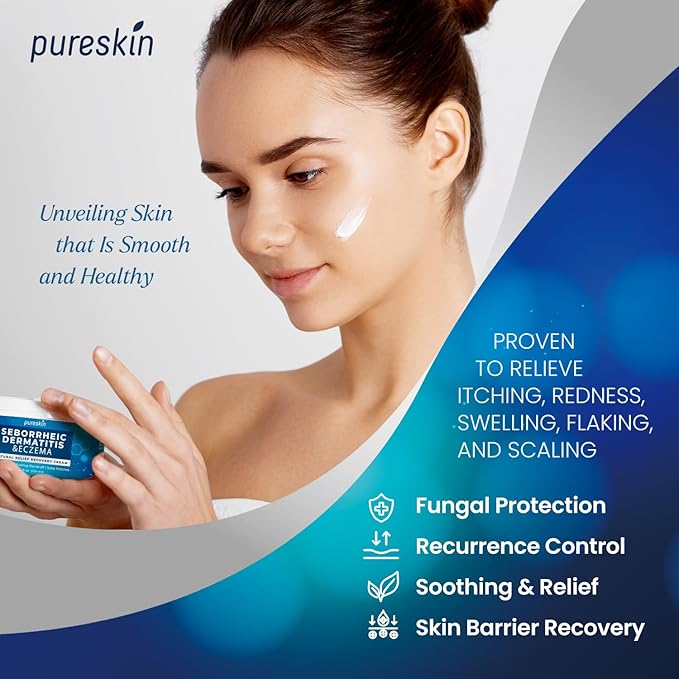 Seborrheic Dermatitis Psoriasis Cream: Antifungal Treatment - Traditional Herbal Infused - Relief for Flaking Irritated Scalp Skin - Steroids Free Lasting Result 3.4 Oz