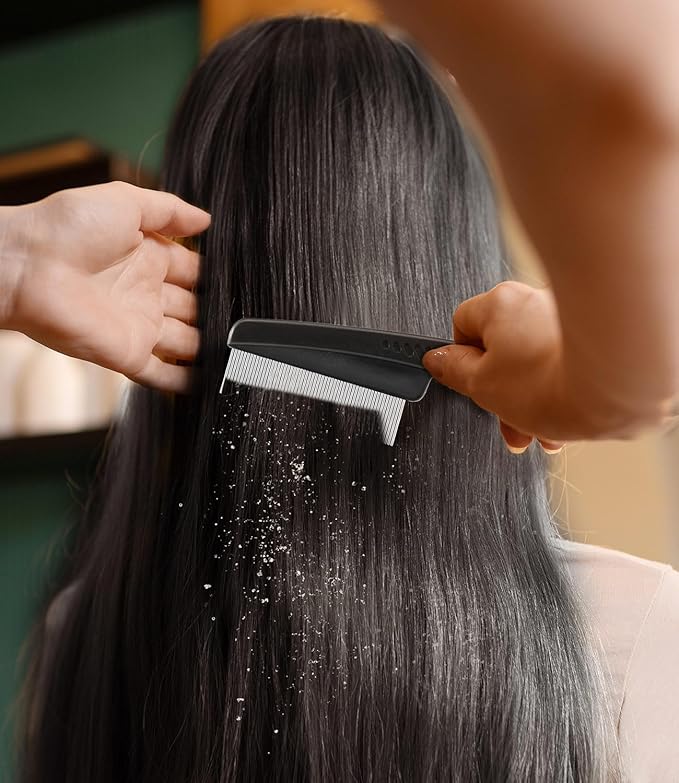 Dandruff Comb Fine Tooth Scalp Detox Comb Lice for Women, Men & Kids Stainless Steel Scalp Detoxing, Sweep & Massage Hair Brush Tool for Hair Care (Red 1PC)