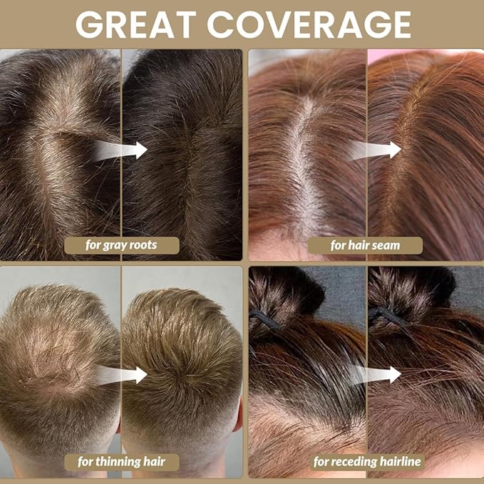 VOLLUCK Root Touch up Powder, Instant Hairline Powder for Thinning Areas and Gray Hair Coverage, Natural and Non-greasy Root Cover up for Women and Men (White, 0.14 Ounce)