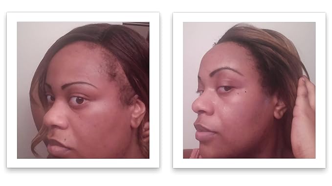 Caboki Hair Volumizer: Root Touch Up, Fill in Hairline & Edges, Cover Thinning, Bald Spots, and Gray Hair - Talc-Free, Healthful Powder for Men and Women. Blonde