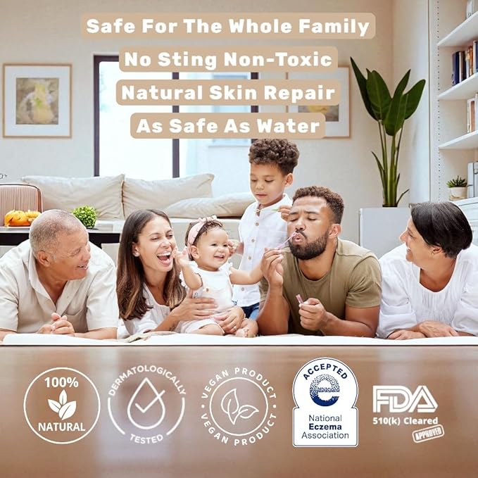 Loma Lux New Eczemol OTC Spray Natural & No Sting Hypochlorous for Eczema, Wounds, Burns, Cuts, Radiation Dermatitis, Skin Irritation, Sunburn, Itchy Skin, for Kids & Adults (8 Fl Oz.)