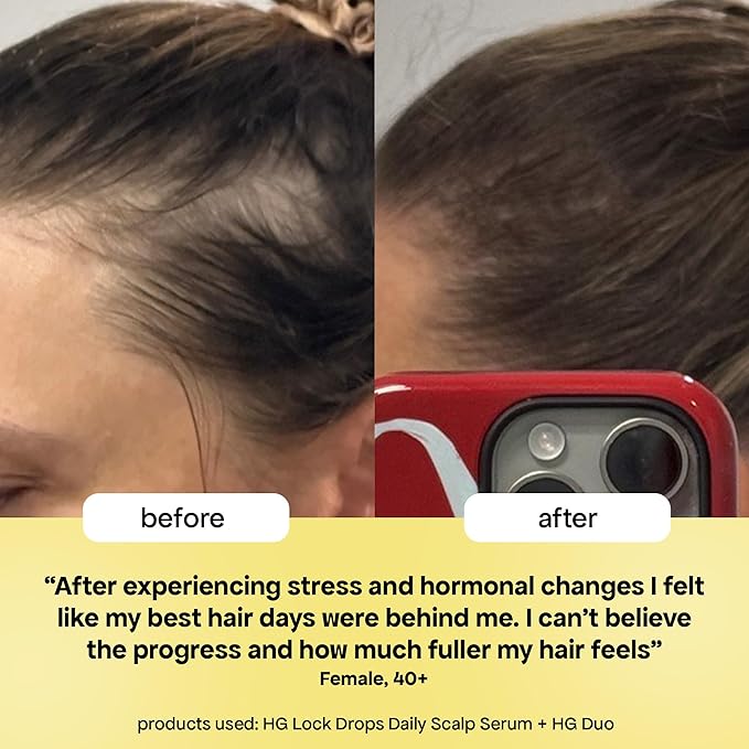 BondiBoost HG Lock Drops Daily Hair Serum for Women – Non-Greasy, Reduces Hair Thinning, Stimulates Scalp, Supports Thicker Fuller Hair – Vegan, Color-Safe, Lightweight for All Hair Types & Textures