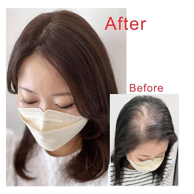 Real Human Hair Topper Double-Monofilament Top Hand-Tied Hair Pieces Mid Length for WomenThinning Hair BHADS812 (3 Natural Brown × Hair Length:9.8"(25cm), Base Size:3.1"×4.7"(8cm×12cm))