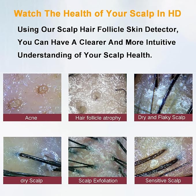 Four-Spectrum Hair Scalp Skin Oil and Analyzer, 15-Inch LCD Screen Hair Skin Analyzer Machine 50X 200X Skin Hair Scalp Detector with Storage Function Four-Grid Comparison