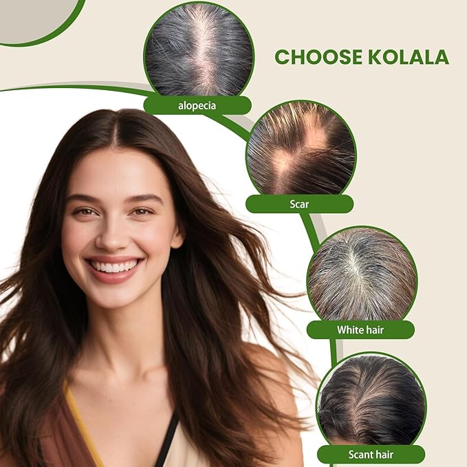 HAIR Toppers for Women Real Human Hair 6x7 inch 150 Density Base 12 inch 55grams medium dark brown Topper for Women with Thinning Hair(#4 12inch)
