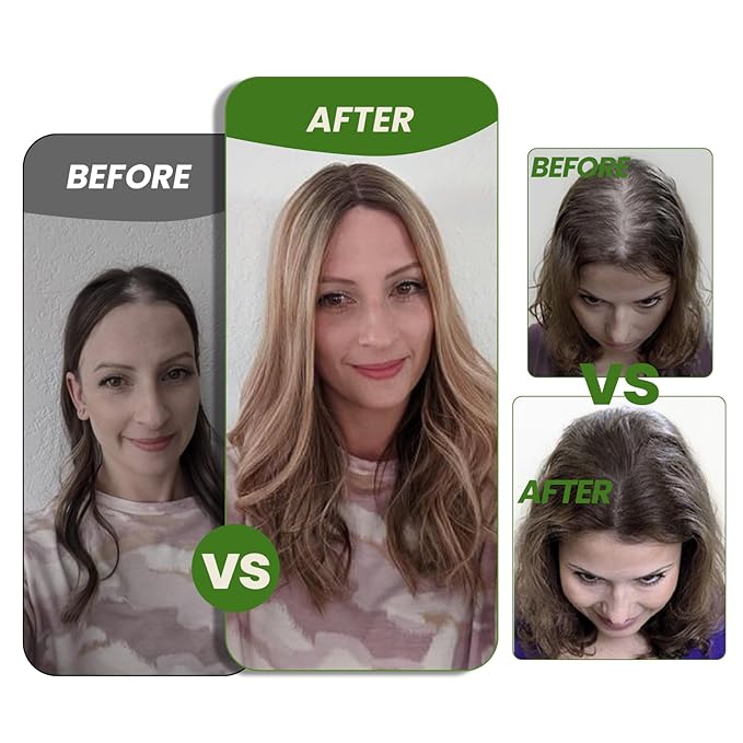 Hair Toppers for Women Real Human Hair 6x7 inch Larger Silk Base 150 Density 55 grams 12inch Balayage Color Chocolate Brown To Caramel Blonde Hair Pieces Add Volume（#4274 12inch）