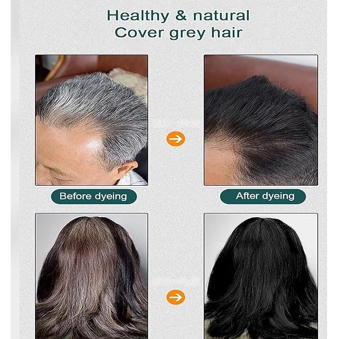 HUANG YI Natural Plant Hair Dye, New Botanical Bubble Hair Dye 30ml 10Packs/Box, Pure Plant Extract for Grey Hair Color Bubble Dye, New Botanical Bubble Hair Shampoo(Dark Brown)