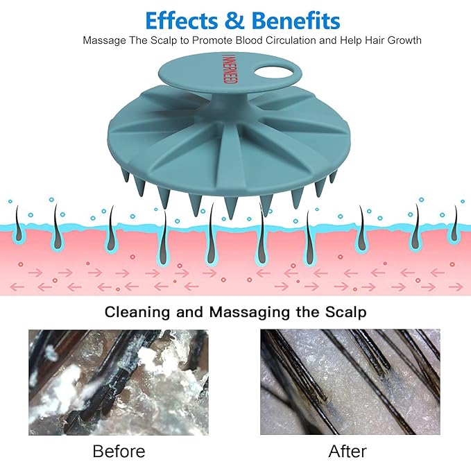 Scalp Massager Shampoo Brush, Wet & Dry Manual Scalp Care Head Scrubber Hair Washing, Soft Silicone Bristles, for Hair Growth, Dandruff Removal, Comfortable for All Hair Types (Dark Green+Pink)