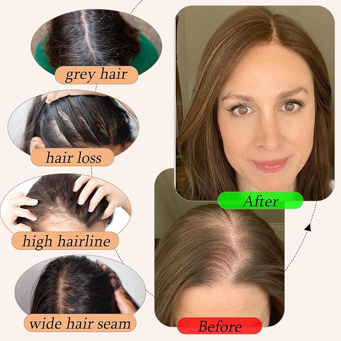 Human Hair Toppers for Women with Thinning Hair Real Human Topper Crown No Bangs 10 Inch #2 Dark Brown
