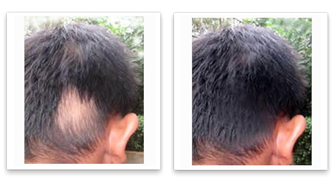 Caboki Thinning Hair Powder for Root Touch Up, Cover Gray & Fill in Hairline Loss, Edges . TALC-Free, Healthful Powder Volumizer for Men and Women. Silver White