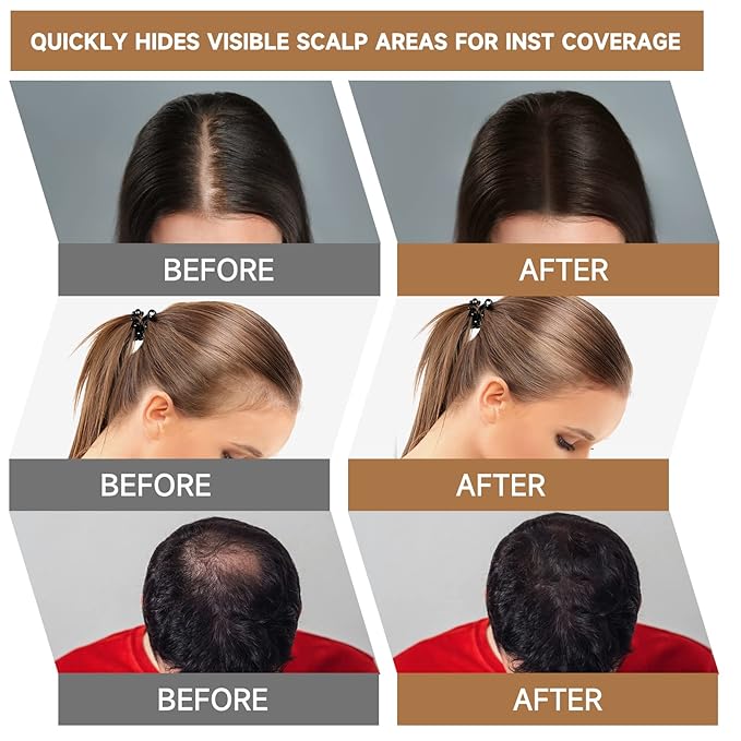 Root Touch Up Powder, Instantly Gray Hair Cover Up, Women Color Root Coverage Shadow Powder for Thinning Grey Hairline, Men Roots Concealer for Hair Loss Beard Line Eyebrow, Auburn