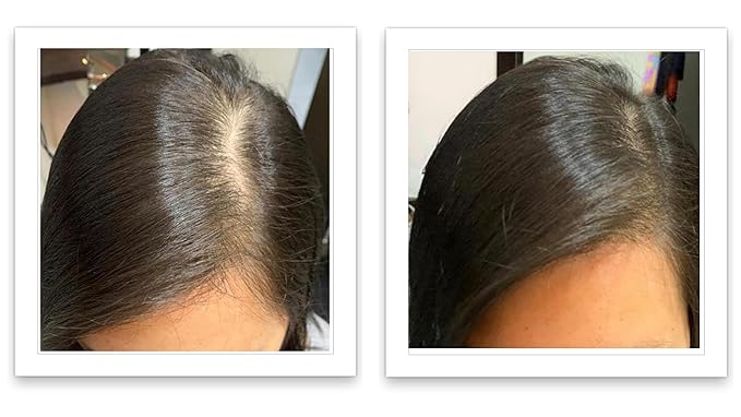 Caboki Hair Volumizer: Root Touch Up, Fill in Hairline & Edges, Cover Thinning, Bald Spots, and Gray Hair - Talc-Free, Healthful Powder for Men and Women. Blonde