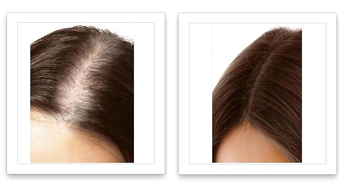 Caboki Root Touch Up Powder: Fill in Thinning Hair, Hairline & Edges, Cover Bald Spots & Gray Hair - TALC-Free, Volumizing Hair Fiber for Men & Women in Salt & Pepper and Dark Shades