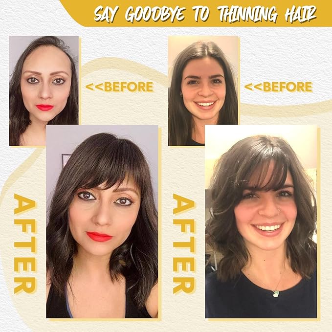 Hair Toppers with Thinning Hairs 100% Real Human Hair Toppers for Women 3D Cover Clip in Bangs 10inch Medium Brown Mix Blonde with Dark Brown Root Topper 120% Density #4T427
