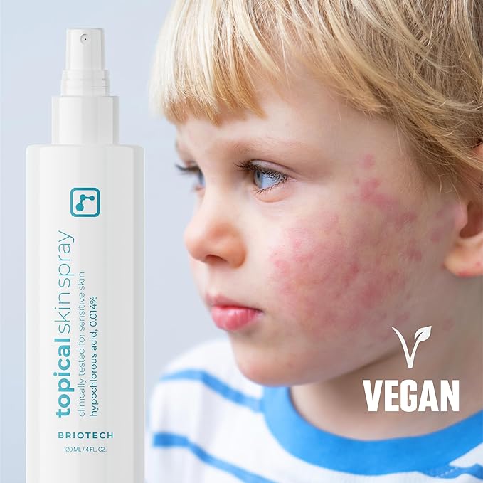 BRIOTECH Topical Skin Spray, Hypochlorous Acid for Sensitive Skin, HOCl Facial Mist, Full Body Support Against Irritation, Calm Redness, Soothe Foot & Scalp, 32 fl oz Refill (1 Pack)