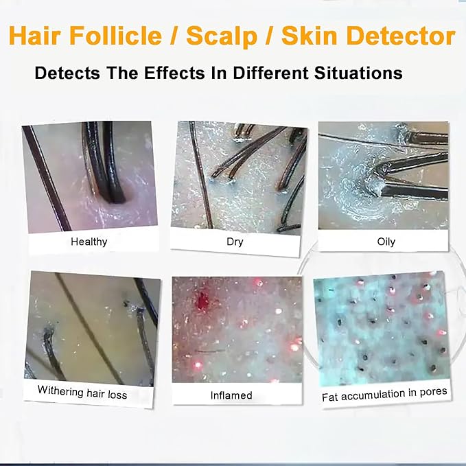 5 in 1 Scalp Skin Hair Follicle Scalp Detector, Multifunction Hair Analyzer Hair Care Machine, 50X 200X Lens Scalp Health Detection for Home Salon Beauty Salon