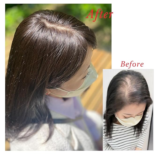 Real Human Hair Topper Pieces Double-Monofilament Top Hand-Tied Mid Length for WomenThinning Hair BHADS914 (BL Natural Black × Hair Length:9.8"(25cm), Base Size:3.5"×5.5"(9cm×14cm))