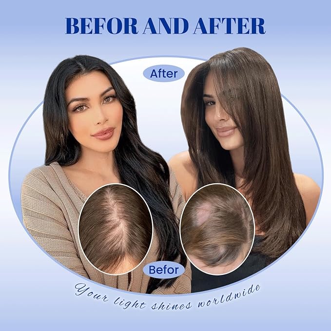 WORLDSTAR Human Hair Toppers for Women Real Human Hair No Bangs 360°3D Coverage Hairpieces Hand-stitched,6 * 7 Inch Base 16Inch #2 Dark Brown,75g with Thinning Hair Upgrade Lace Base (tp#2-16)