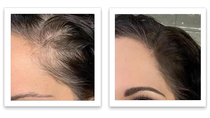 Caboki Hair Volumizer: Root Touch Up, Fill in Hairline & Edges, Cover Thinning, Bald Spots, and Gray Hair - Talc-Free, Healthful Powder for Men and Women. Blonde