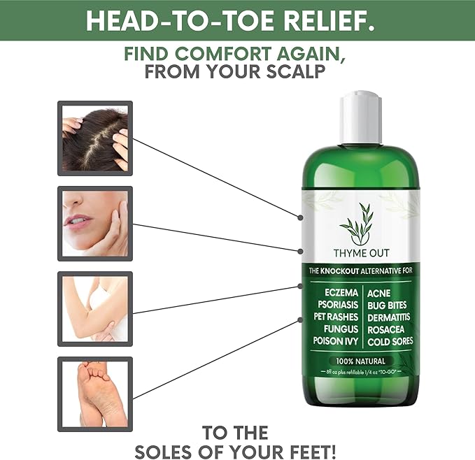 All Natural Eczema Treatment- Psoriasis Treatment - an All-in-One Solution for Acne, Dermatitis, Rosacea, Cold Sores, Pet Rashes, Bug Bites, and Poison Ivy - Anti-Itch Spray for Itchy Skin Relief