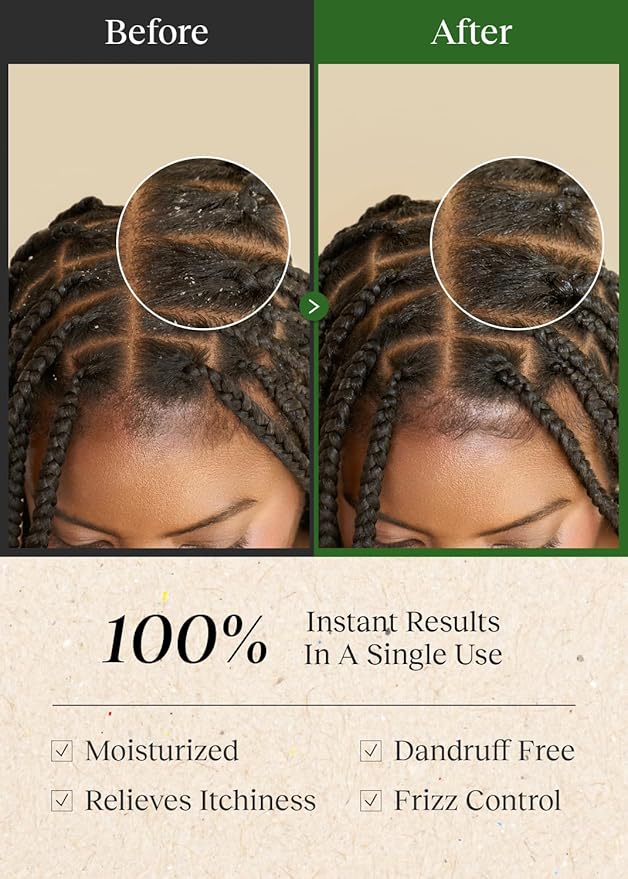 Scalp Cleansing Toner with Apple Cider Vinegar for Braiding Hair, No-Rinse Moisturizing Scalp Exfoliator, 6.76 Fl Oz