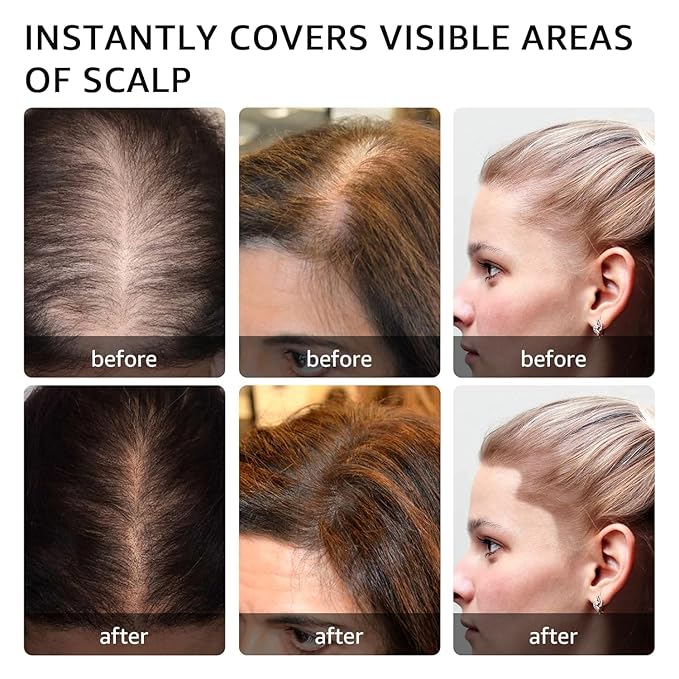 Root Touch Up Hair Color Powder For Concealing Hair Loss and Thinning, Gray Hair Shadow Powder Root Cover Up Hairline Powder For Women Men Eyebrows, Beard Line