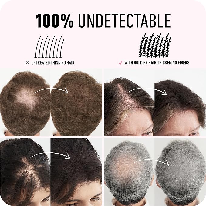 BOLDIFY Hair Fibers (56g) - Fill In Thinning and Fine Hair for an Instantly Fuller, Thicker Look - 14 Shades for Women & Men - Dark Brown