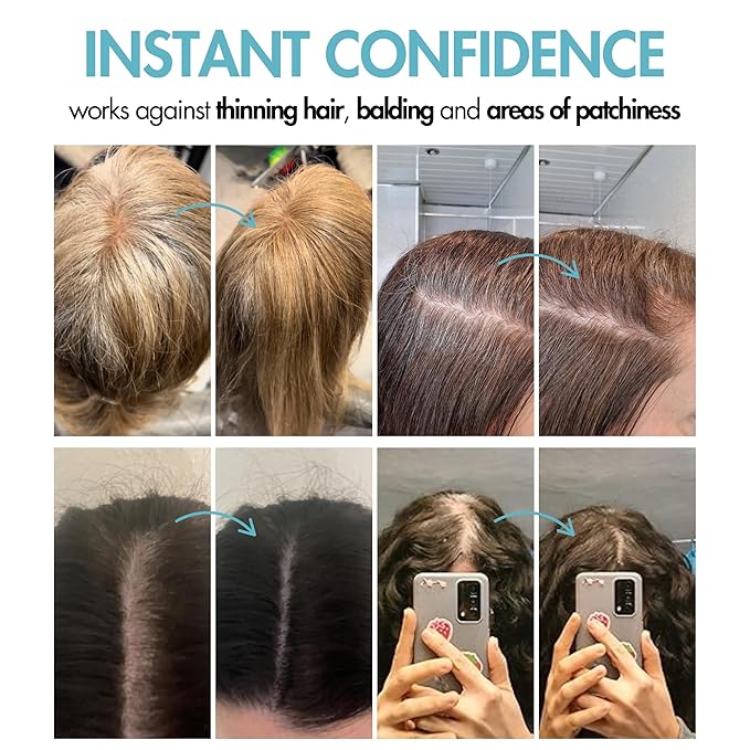 Hair Genetics Root Cover Up Hide Your Grey Hairs Roots NEW Mineral Powder Technology Natural looking Results in Seconds Root Touch Up Powder (Dark Brown)